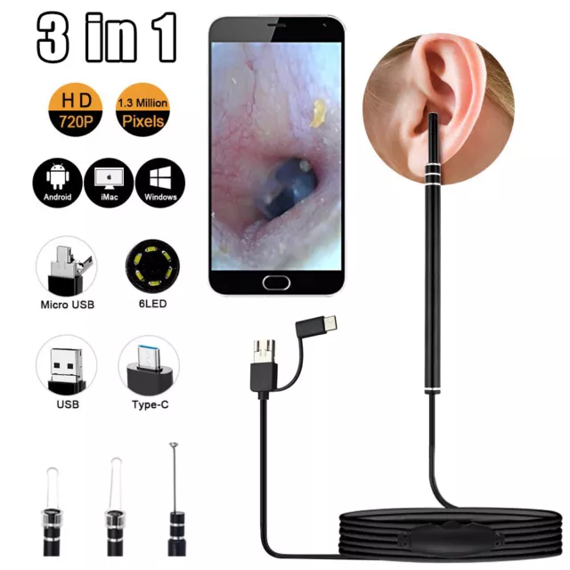 LED HD Ear Endoscope Otoscope Ear Wax Cleaning Camera Tool Cleaner Removal Kit