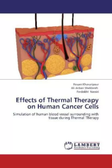 Effects of Thermal Therapy on Human Cancer Cells Hesam Khavaripour (u. a.) Buch