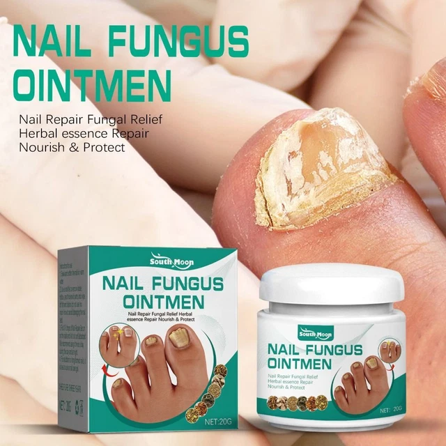 ANTI FUNGAL PARONYCHIA Care Ointment Nail Fungus Treatment Serum Cream