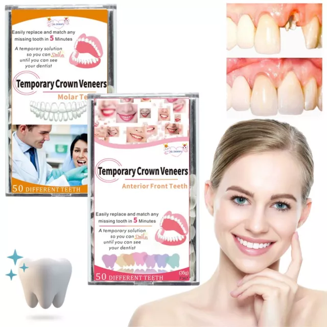 Kit temporaneo di riparazione denti per riempire i denti rotti mancanti e le lacune