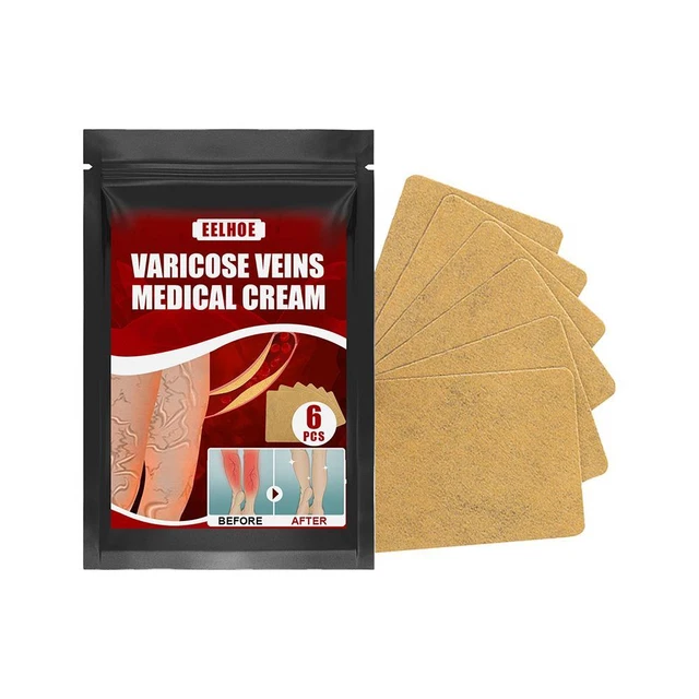 Effective Varicose Vein Relief Patch Body Leg Vasculitis Phlebitis Spider FS2#