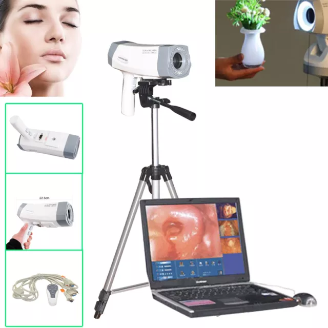 Digital Video Electronic Colposcope+Soft​ware Camera 800,000 pixels +Tripod