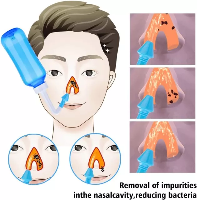 Neti Pot Sinus Kit de rinçage nasal pour adultes et enfants Bleu 300 ml Remèdes* 3