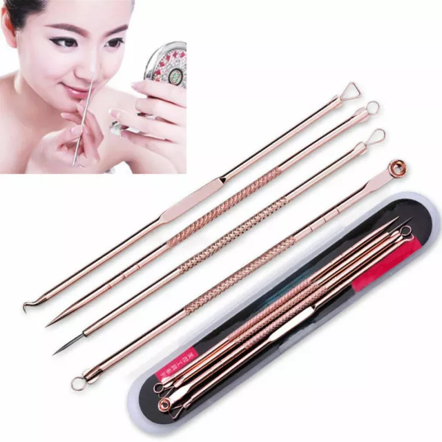 4Pcs Set Pimple Blemish Blackhead Comedone Acne Extractor Remover Needles A41 G