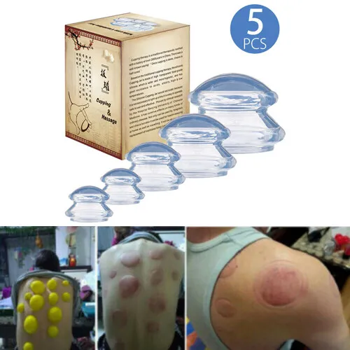 5pcs Silicone Medical Vacuum Massage Cupping Cups Therapy Anti Cellulite Set US