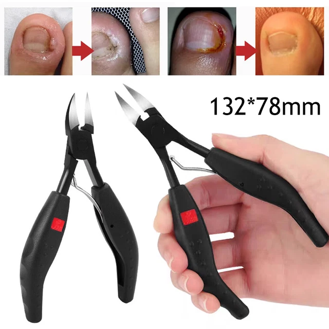 Kit D'outils De Podologie/manucure - Pinces, Coupe-ongles, Ciseaux En Inox, Neuf