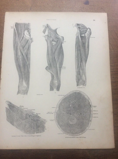 Ohhvvow Poster Tela Anatomia Umana - Stampa Medica Vintage Con Scheletro E Muscoli - Quadro Educativo Senza Cornice 40x45 Cm, Decorazione Moderna Per Studio E Camera