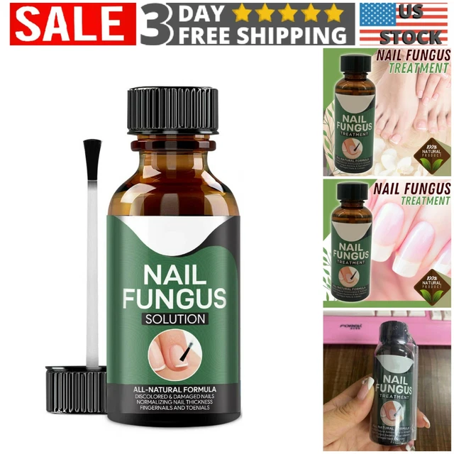 NAIL FUNGUS ANTIFUNGAL Home Treatment Toe and Finger Nail Infection