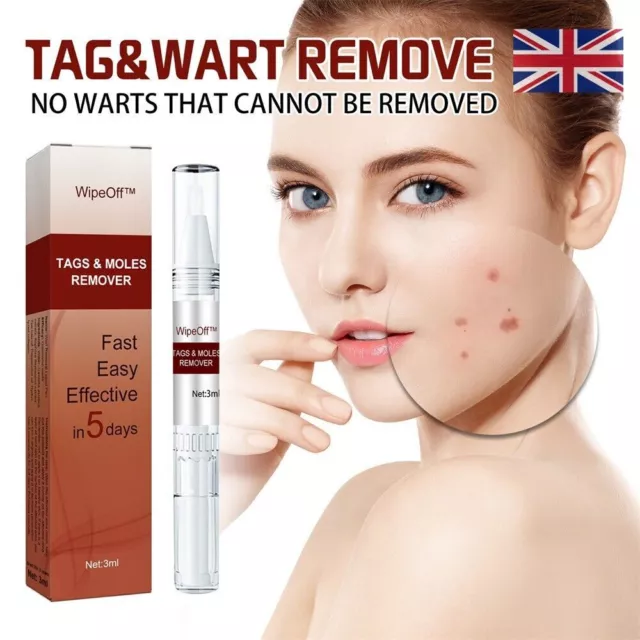 Wipe Off Skin Tags & Moles Warts Corn Remover - Restore Skin Health & Beauty UK