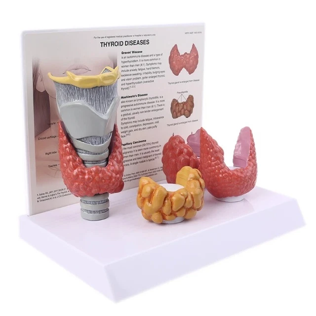 HUMAN ANATOMICAL THYROID Gland Model for Pathology Anatomy Study ...