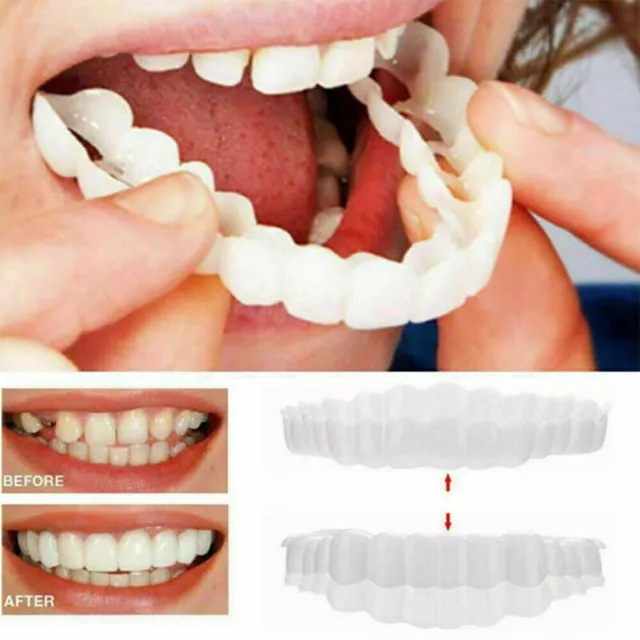 1Set TOP & BOTTOM Teeth Veneers Cover Instant Cosmetic Fix Cap Smile Perfect·