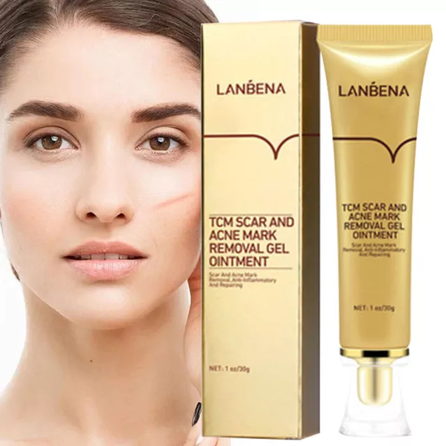 LANBENA Pimple Scar Acne Mark Spots Removal Treatment Gel Ointment Blemish Cream
