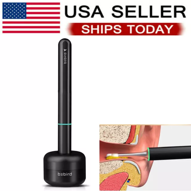 BEBIRD X17 Pro Ear Wax Removal Camera Endoscope Professional Visual Ear Cleaner