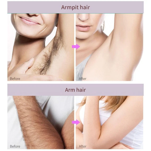 Crema natural permanente para depilación piel suave spray personal gen cuerpo NUEVO. U0Q5