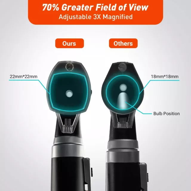 Scian Otoskop Ear Scope mit LED Licht professionelles Pocket Mini Otoscopes Set 3