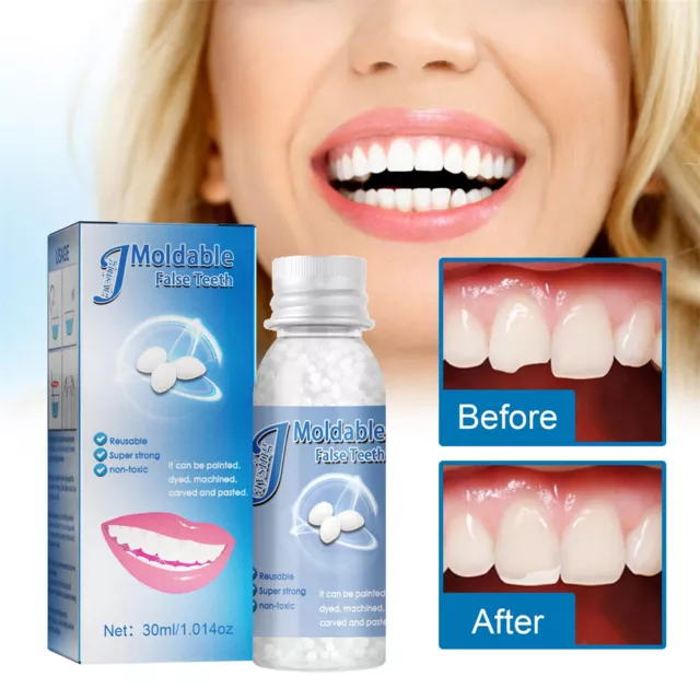Temporary Tooth Repair Kit Resin Fix Broken Teeth Fill Gaps Dental Denture √√√