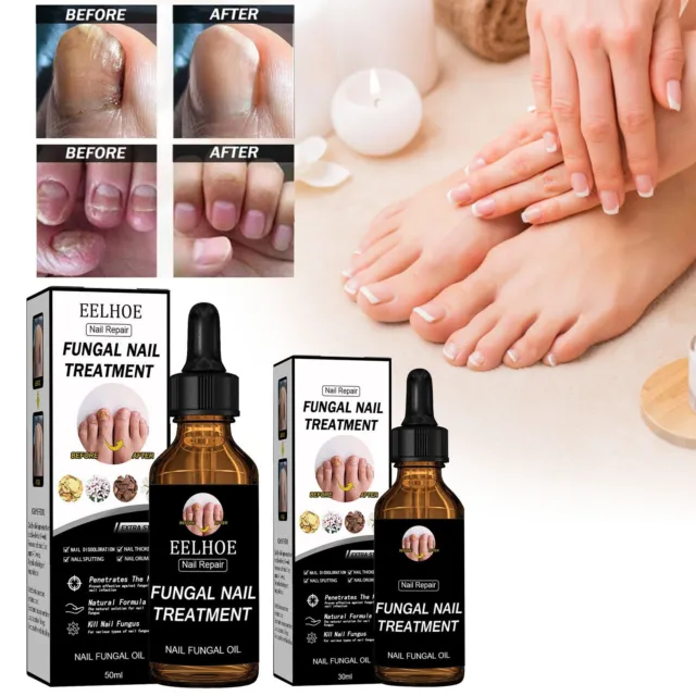 Nail Fix Solution Thickened Bright Nails To Get Rid Of Nail Dead Skin Fix