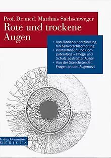 Rote und trockene Augen von Sachsenweger, Matthias | Buch | Zustand gut