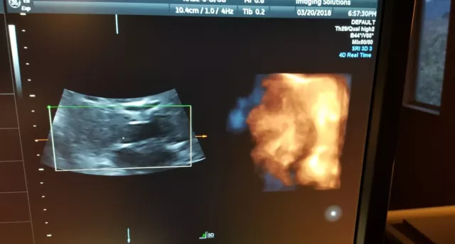 De mesa portátil Doppler Color 2D Embarazo bebé cardiaca 3D 4D Ecógrafo -  China Máquina de ecógrafo portátil, máquina de ultrasonido ultrasonido