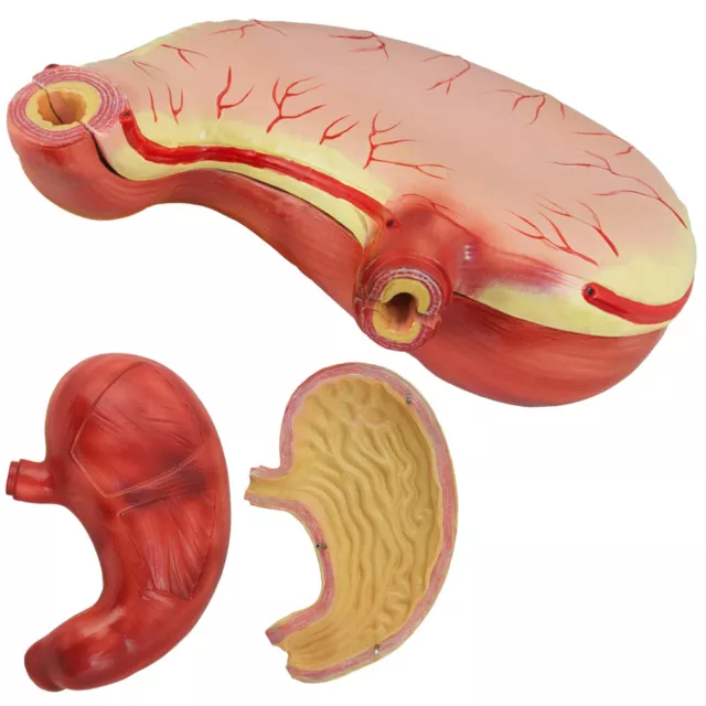 Anatomie Modell Magen des Menschen Magenmodellmodell Anatomiemodell groß medmod