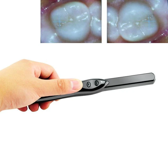 High-Resolution 6MP Dental Intraoral Camera with 6-LEDs for Clear Oral Health