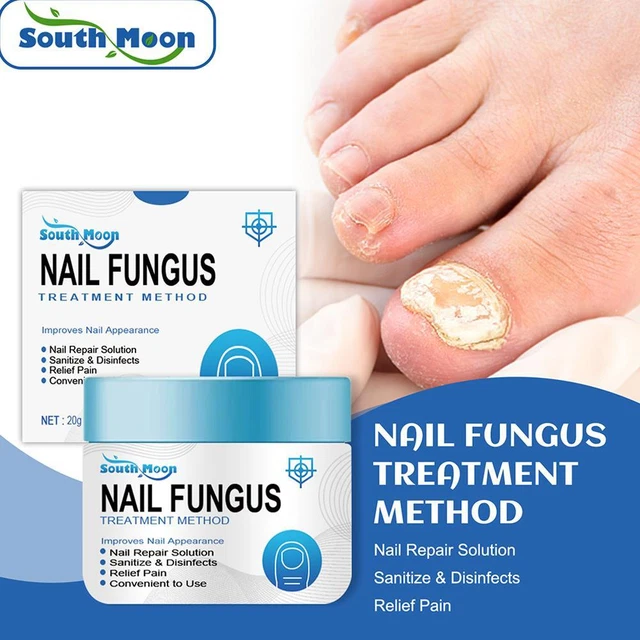 NAIL FUNGUS FUNGAL Removal Cream Treatment Care Onychomycosis Infection