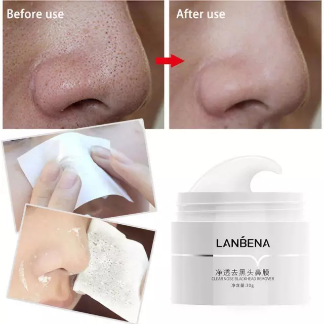 LANBENA Blackhead Remover Cream Facial Nose Mask Plant Acne Strips Lady N1X8 2