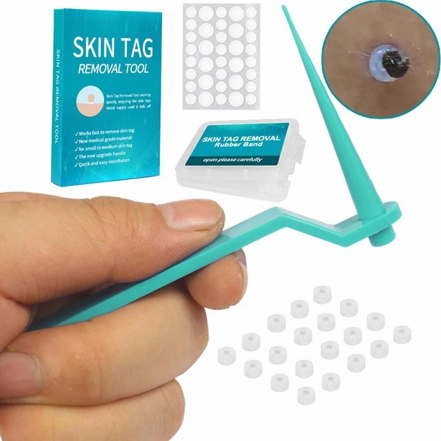 Enlever les étiquettes de peau en toute sécurité et facilement à la maison 2