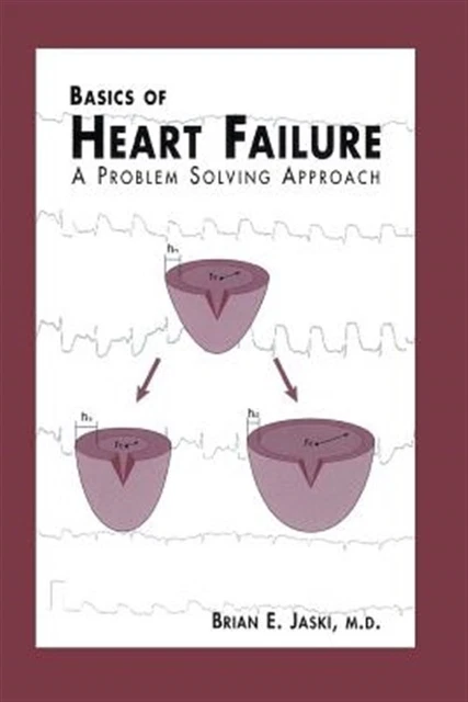BASICS OF HEART Failure : A Problem Solving Approach, Paperback by ...