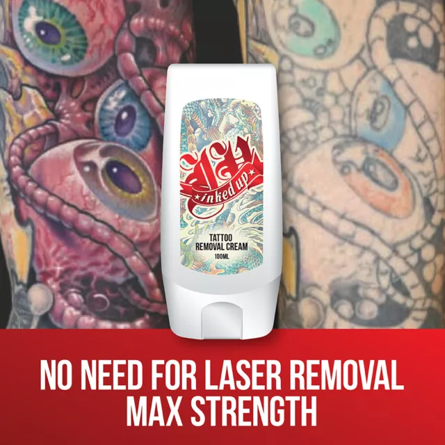 Inked Up Tattoo Removal Cream – Remove Your Tattoo Fast Targets Ink Clear