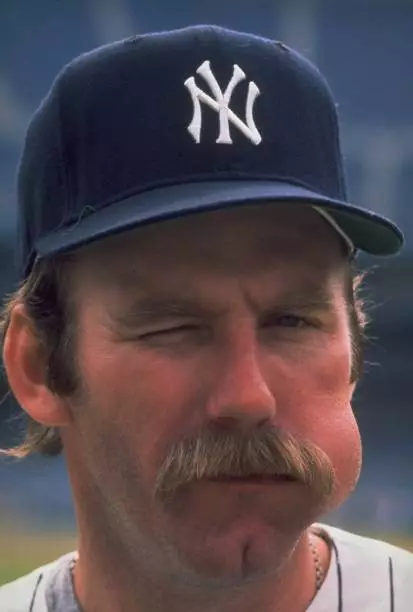 Closeup portrait of New York Yankees Sparky Lyle chewing tobacco b - Old Photo