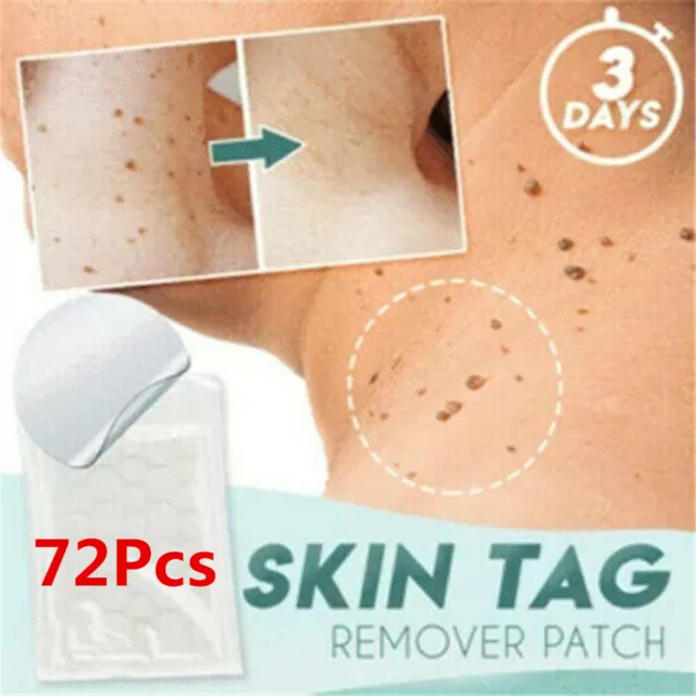 Akne Pflaster Set Skin Tag Entferner Patch Anti Pickel Mitesser Skin Tag Remover