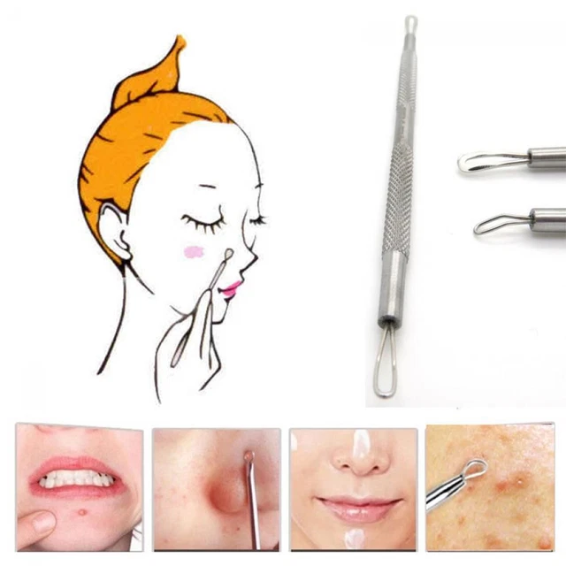 Sell Blemish Extractor Blackhead Remover Tool Stainless Steel Pimple Needles