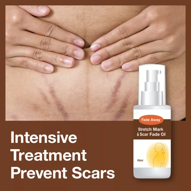 Fade Away Stretch Mark & Scar Fade Oil – Removes Colour & Texture Of Marks