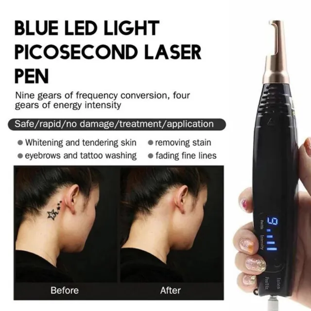 Picosecond Pico Second Picosured Laser Beauty Machine Tattoo Pigment Removal Pen 2