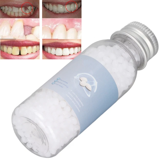 Cuentas de relleno dental temporales dientes postizos moldeables cuentas de ajuste térmico TDM