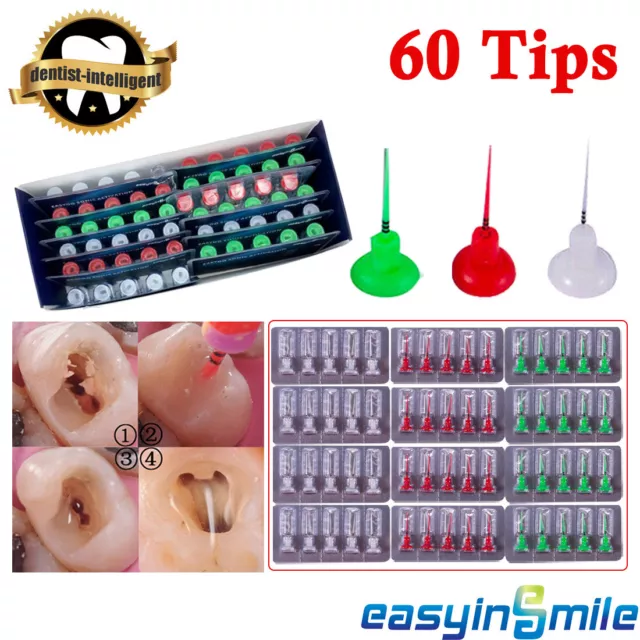 60Pc Dental Endodontic EASYDO Endo Activator Irrigator Tips Endo Ultra Activator