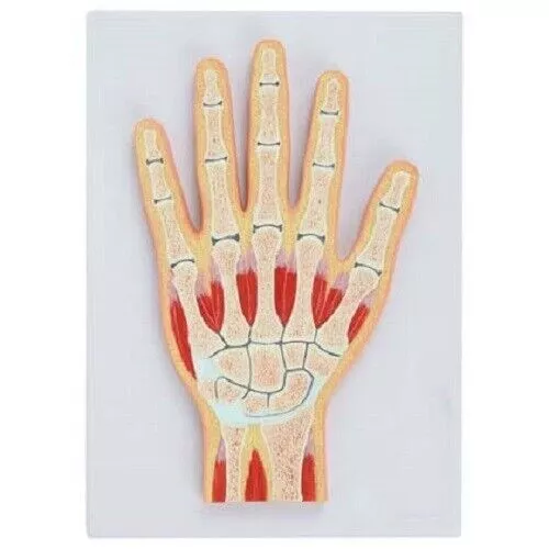 Ajanta Exports Hand Joint Section Model Hand anatomy model Hand structure model