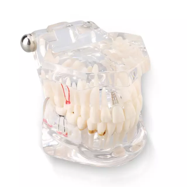 Dental Disease Teaching Study Adult Typodont Demonstration Teeth Model New