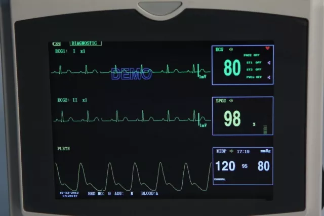 Le moniteur du patient contient une température ECG NIBP REP SPO2 PR 3