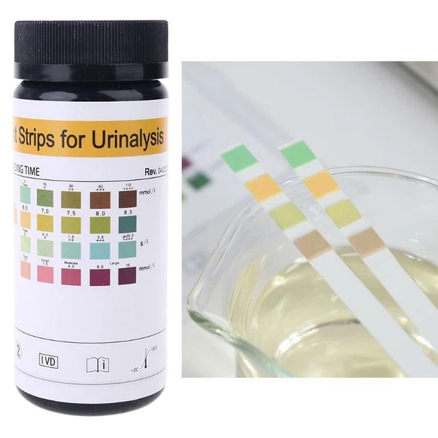 100 STRIPS URS4K Glucose pH Protein Ketone Urine Test Paper Strips
