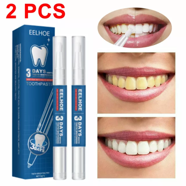 2PCS Zahnweiß Gel Stift Extra Stark Weiß Hygiene Zahn Zahnstein-Entfernung Au *