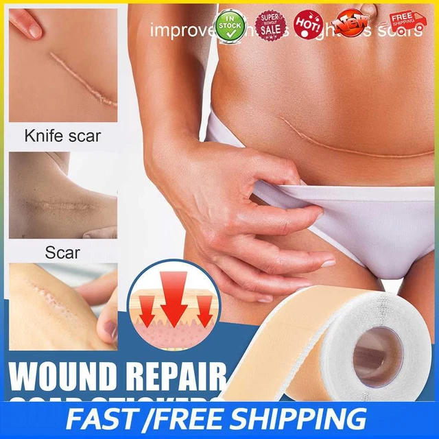 #b 150 cm Hoja de cicatrices Autoadhesiva Silicona Belleza Pegatina Ajustable para Hombre Mujer