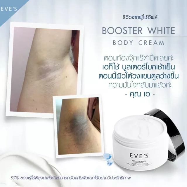 Crema corporal blanca EVE'S manchas oscuras más brillantes piel axila marca elástica