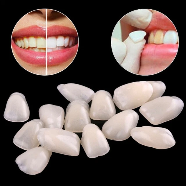 Dental Ultra-Thin Whitening Veneers Resin Teeth Upper Anterior Shade A1 .zy
