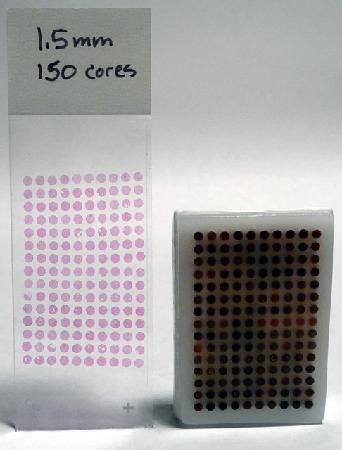 TMA Arraymold Tissue Microarray 1.5mm 150 Core Pathology Histology Research