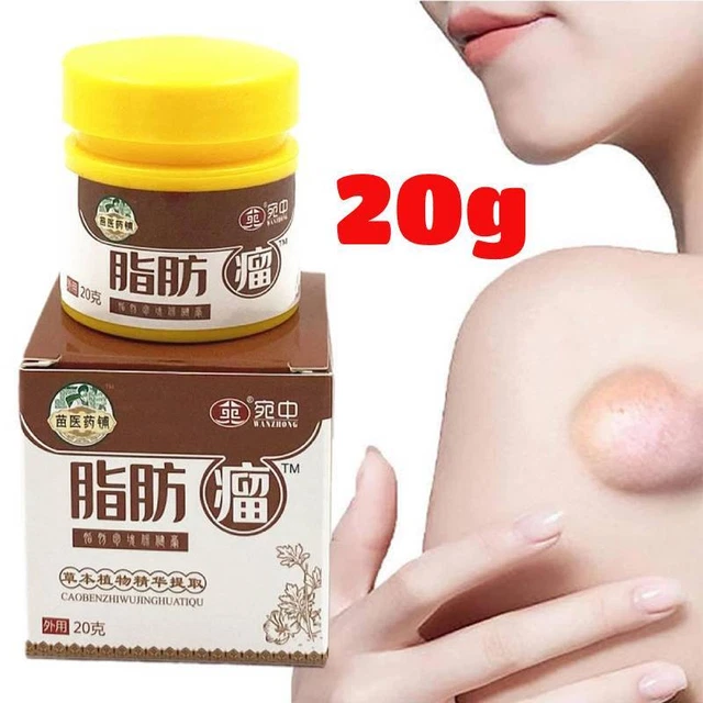 Crema de eliminación de lipomas HuangFuTang, crema de eliminación de lipomas sin bultos*