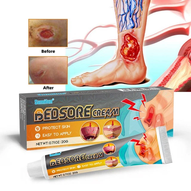 BED SORE CREAM Bedsore Ointment Bed Sores Treatments Fast Wound Healing