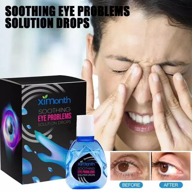 Gotas calmantes para los ojos solución de problemas oculares ATTDX 10 ml A2F2
