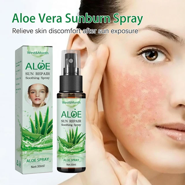 Aerosol calmante de reparación de aloe vera para el alivio del acné quemaduras solares I1Q3 hidratante V1U1